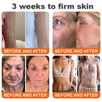 Made and Shipped from USA✨ CureVivo® Botox Bee Venom Firming Cream(🔥LAST DAY 70% OFF)💄