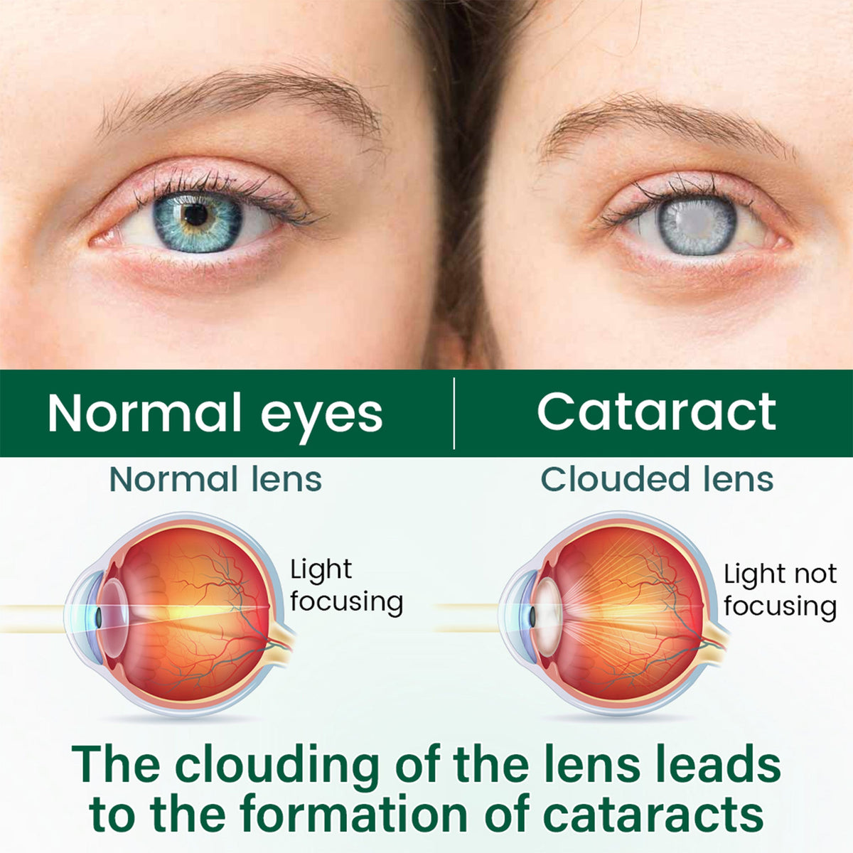 🧑‍⚕️CureVivo® Nano Clear Vision Eye Roller Serum – Professional Eye Comfort & Vision Support