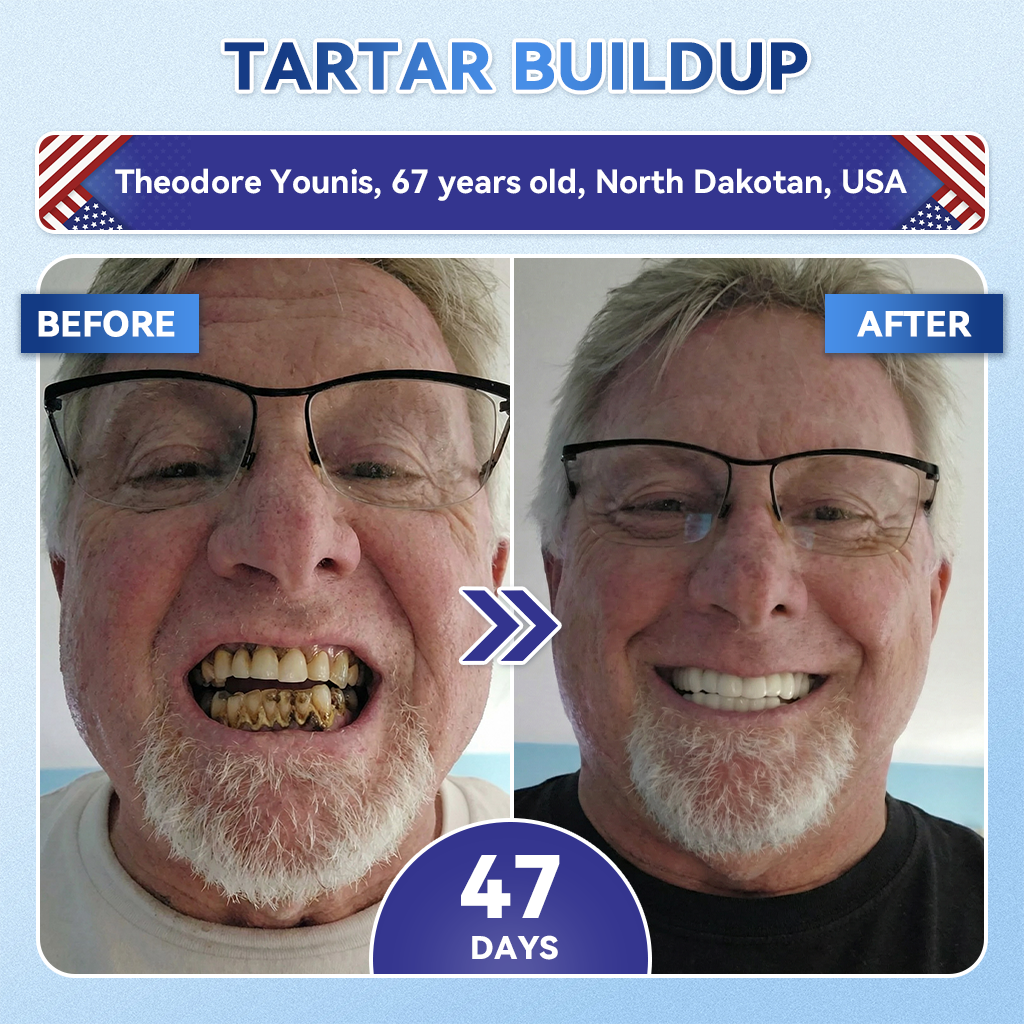 🦷GаrаgеLіnе®😜Tideglusib Fast‑Dissolving Tooth & Gum Repair Oral Strips🎨🎨(Supports tooth repair and helps relieve gum discomfort and other common oral concerns)