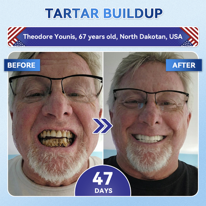 🦷GаrаgеLіnе®😜Tideglusib Fast‑Dissolving Tooth & Gum Repair Oral Strips🎨🎨(Supports tooth repair and helps relieve gum discomfort and other common oral concerns)