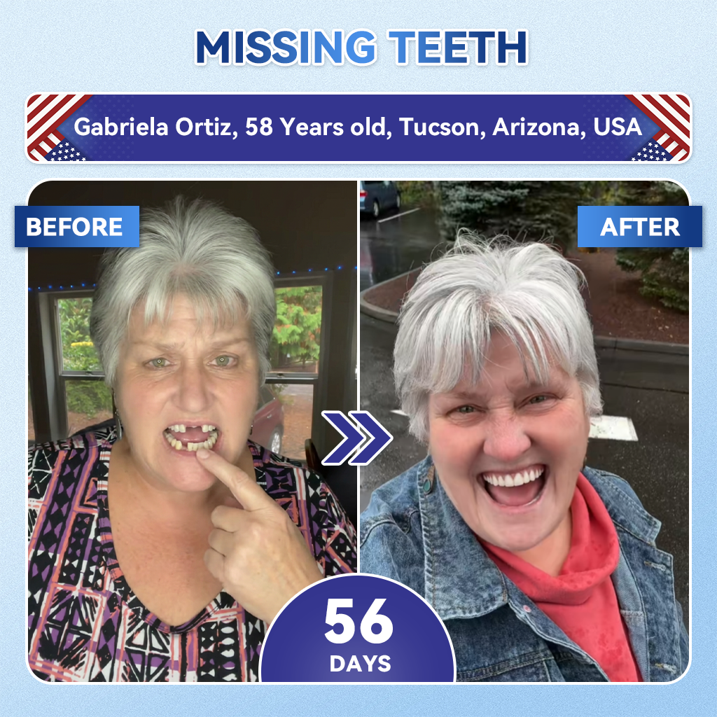 🦷GаrаgеLіnе®😜Tideglusib Fast‑Dissolving Tooth & Gum Repair Oral Strips🎨🎨(Supports tooth repair and helps relieve gum discomfort and other common oral concerns)
