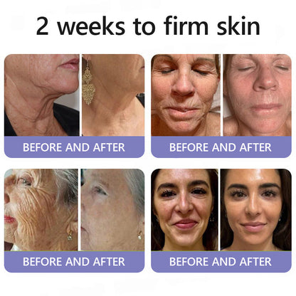 🛡️Official Brand Store | Turonu® Wrinkle-Reducing & Lifting Roller Cream 🏵️ Smoother skin in as little as 3 days