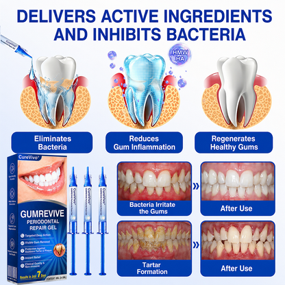 CureVivo® GumRevive Periodontal Repair Gel👄