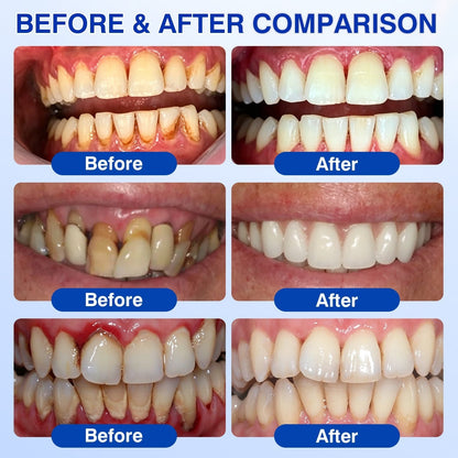 CureVivo® GumRevive Periodontal Repair Gel👄