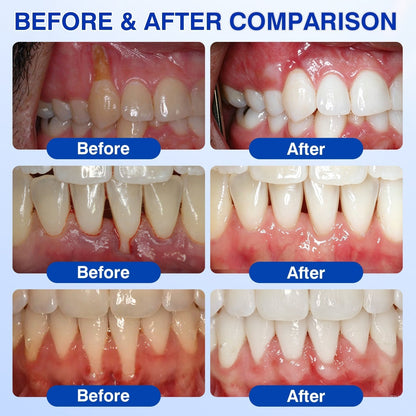 CureVivo® GumRevive Periodontal Repair Gel👄