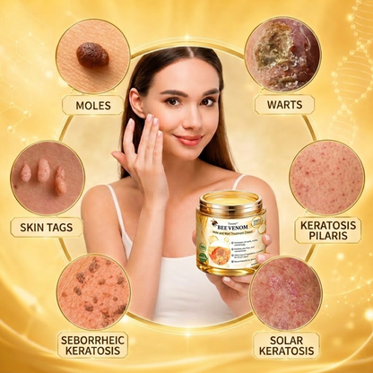 🐝 Turonu® Advanced Bee Venom Treatment for Warts and Skin Imperfections 👨‍⚕️ Inspired by dermatological science | Targeted care at home