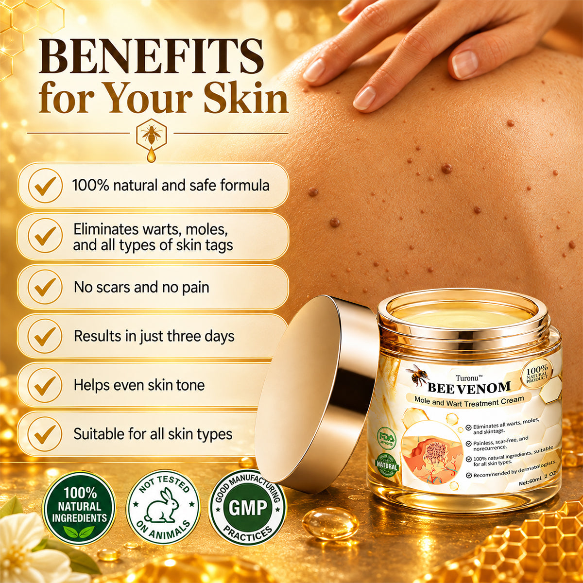 🐝 Turonu® Advanced Bee Venom Treatment for Warts and Skin Imperfections 👨‍⚕️ Inspired by dermatological science | Targeted care at home
