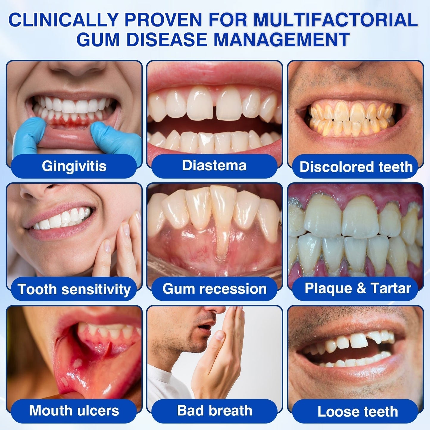 CureVivo® GumRevive Periodontal Repair Gel👄