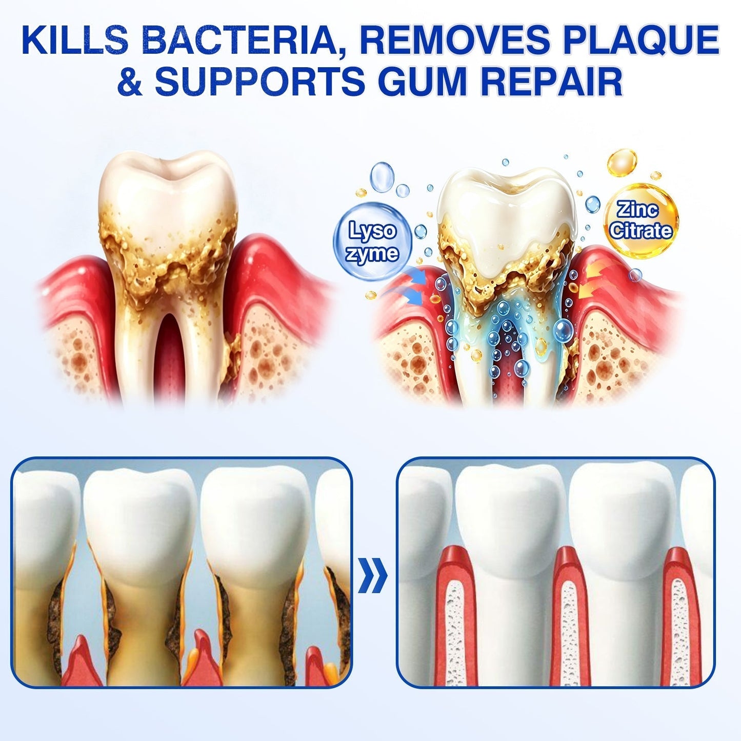CureVivo® GumRevive Periodontal Repair Gel👄
