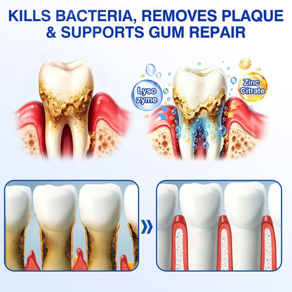 CureVivo® GumRevive Periodontal Repair Gel👄