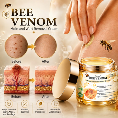 🐝 Turonu® Advanced Bee Venom Treatment for Warts and Skin Imperfections 👨‍⚕️ Inspired by dermatological science | Targeted care at home