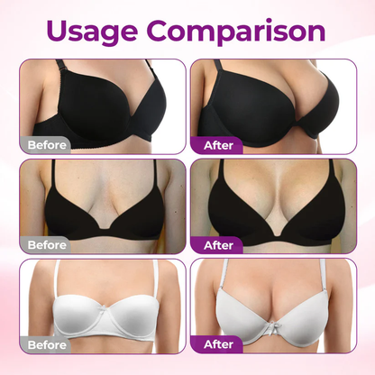 💥Turonu® 💥Targeted Breast Enhancement Advanced Nano Microneedle Patch💃