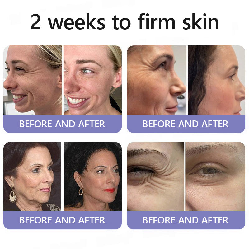 🛡️Official Brand Store | Turonu® Wrinkle-Reducing & Lifting Roller Cream 🏵️ Smoother skin in as little as 3 days