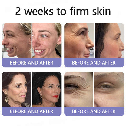 🛡️Official Brand Store | Turonu® Wrinkle-Reducing & Lifting Roller Cream 🏵️ Smoother skin in as little as 3 days