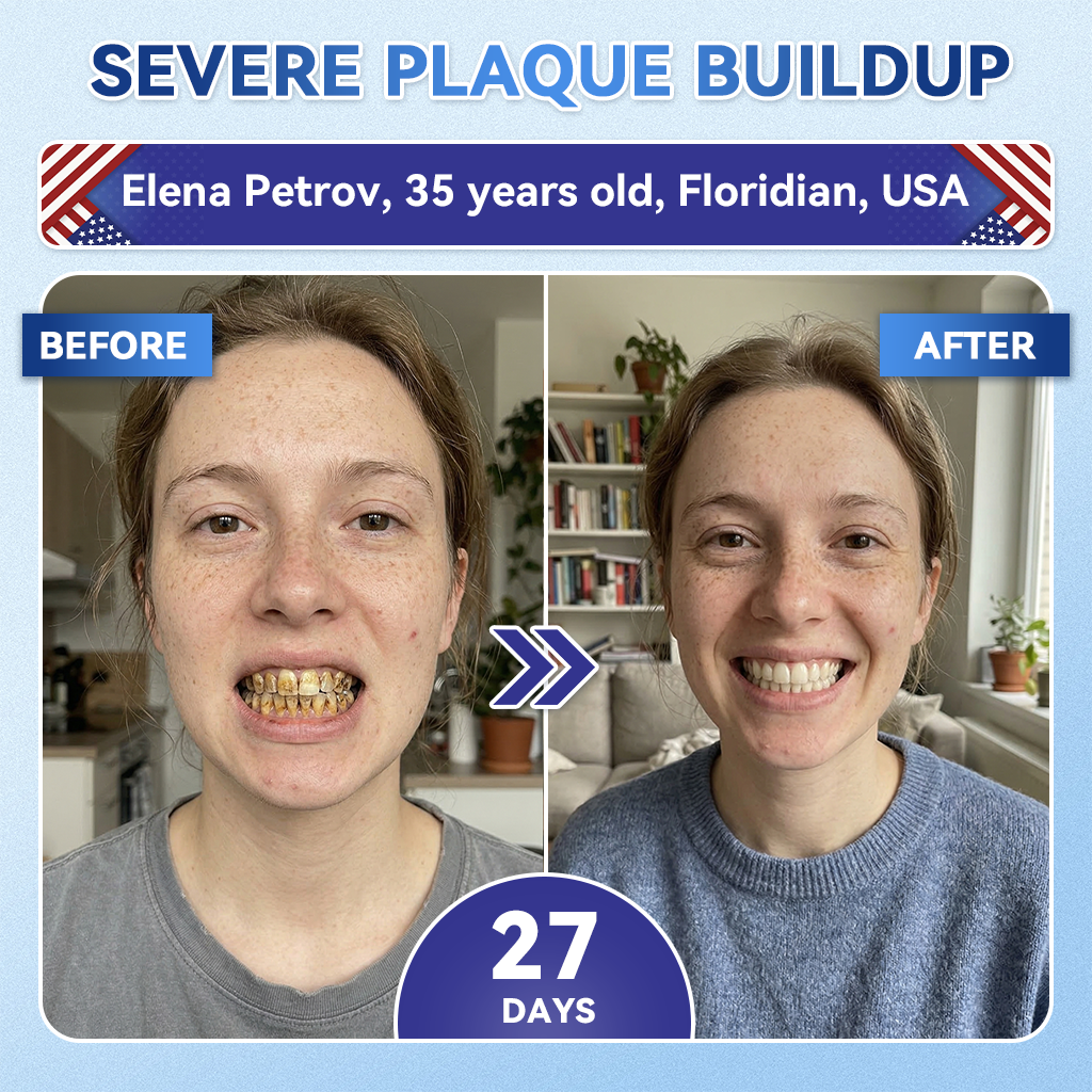 🦷GаrаgеLіnе®😜Tideglusib Fast‑Dissolving Tooth & Gum Repair Oral Strips🎨🎨(Supports tooth repair and helps relieve gum discomfort and other common oral concerns)