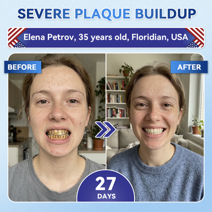 🦷GаrаgеLіnе®😜Tideglusib Fast‑Dissolving Tooth & Gum Repair Oral Strips🎨🎨(Supports tooth repair and helps relieve gum discomfort and other common oral concerns)