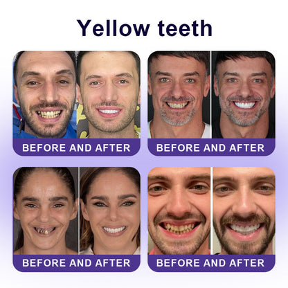 ✅Official Store |🦷GarageLine® Nano-Hydroxyapatite Purple Whitening Strips - Professional Enamel Care & Brightening