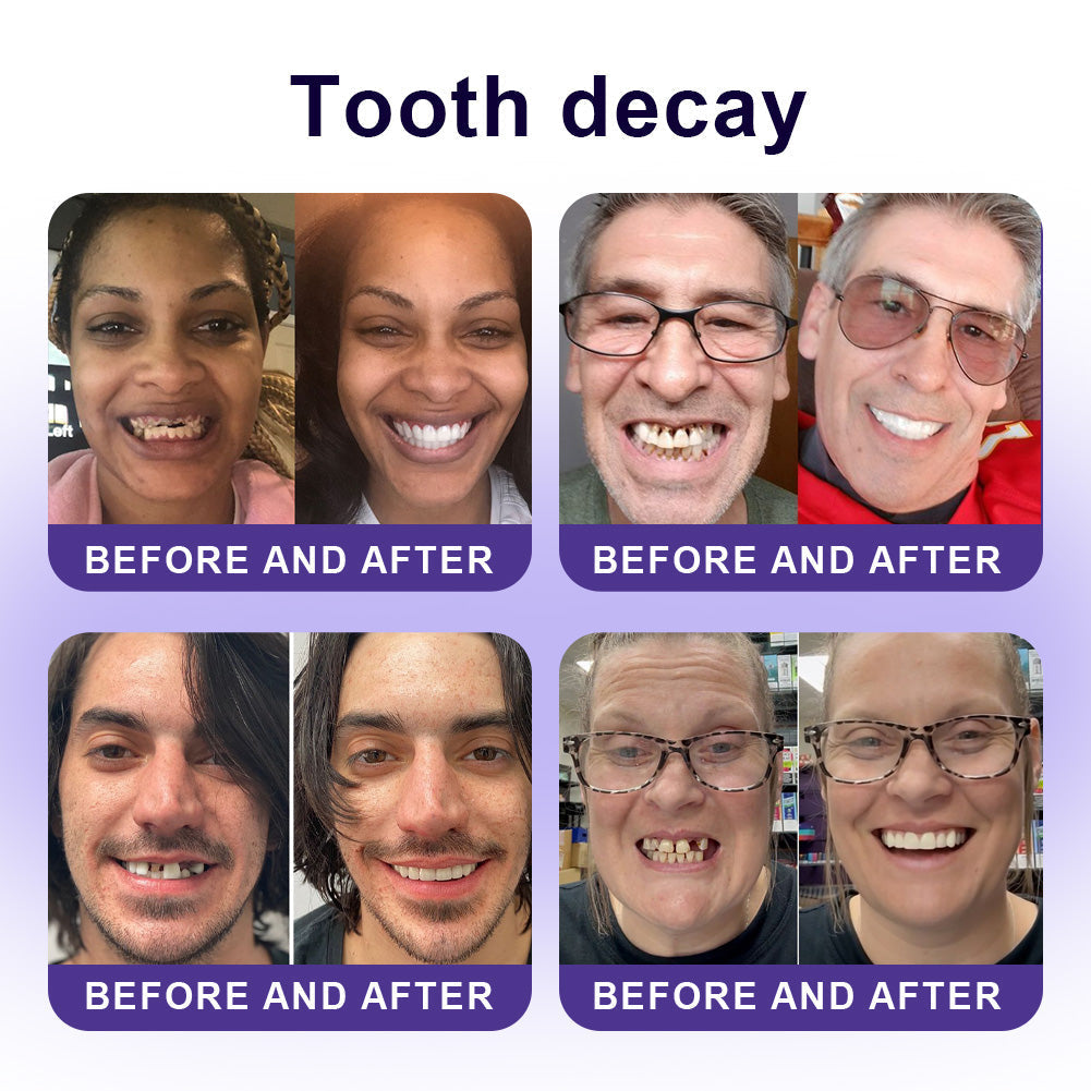 ✅Official Store |🦷GarageLine® Nano-Hydroxyapatite Purple Whitening Strips - Professional Enamel Care & Brightening