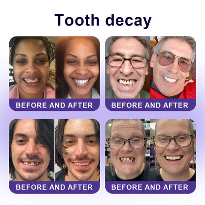 ✅Official Store |🦷GarageLine® Nano-Hydroxyapatite Purple Whitening Strips - Professional Enamel Care & Brightening