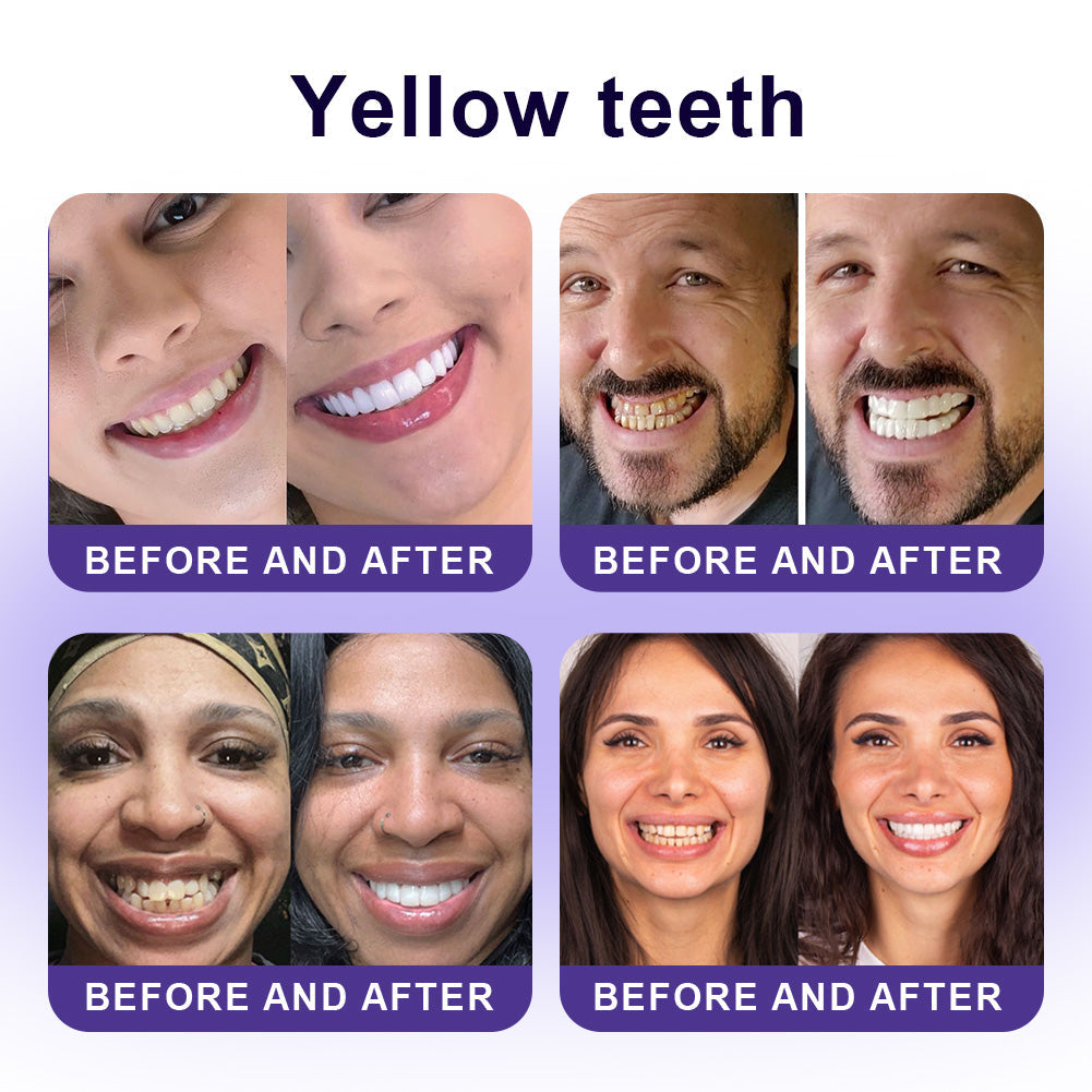 ✅Official Store |🦷GarageLine® Nano-Hydroxyapatite Purple Whitening Strips - Professional Enamel Care & Brightening