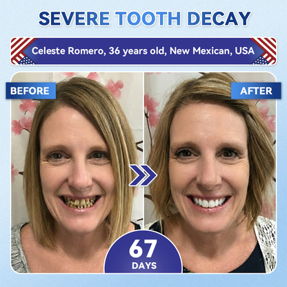 🦷GаrаgеLіnе®😜Tideglusib Fast‑Dissolving Tooth & Gum Repair Oral Strips🎨🎨(Supports tooth repair and helps relieve gum discomfort and other common oral concerns)