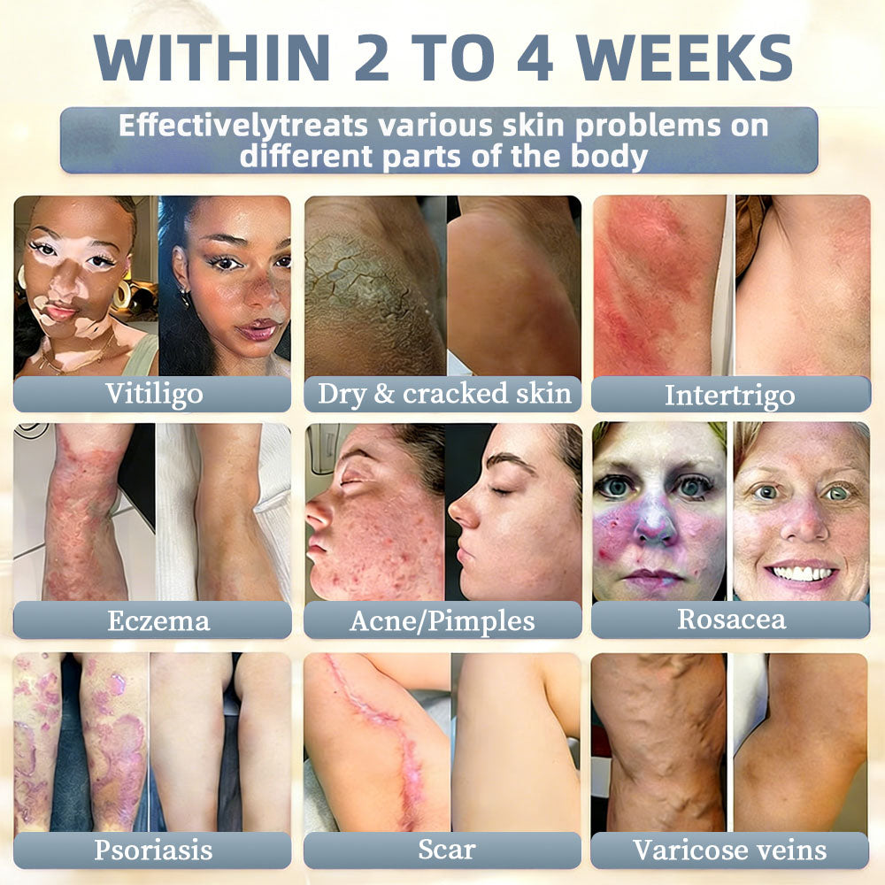 🇺🇸ТRILUMIA® Clinical Treatment & Repair Cream 🗽👩‍⚕️ – See a Noticeable Difference in Just Days A Simple, Non-Invasive Approach to Smoother, Healthier-Looking Skin