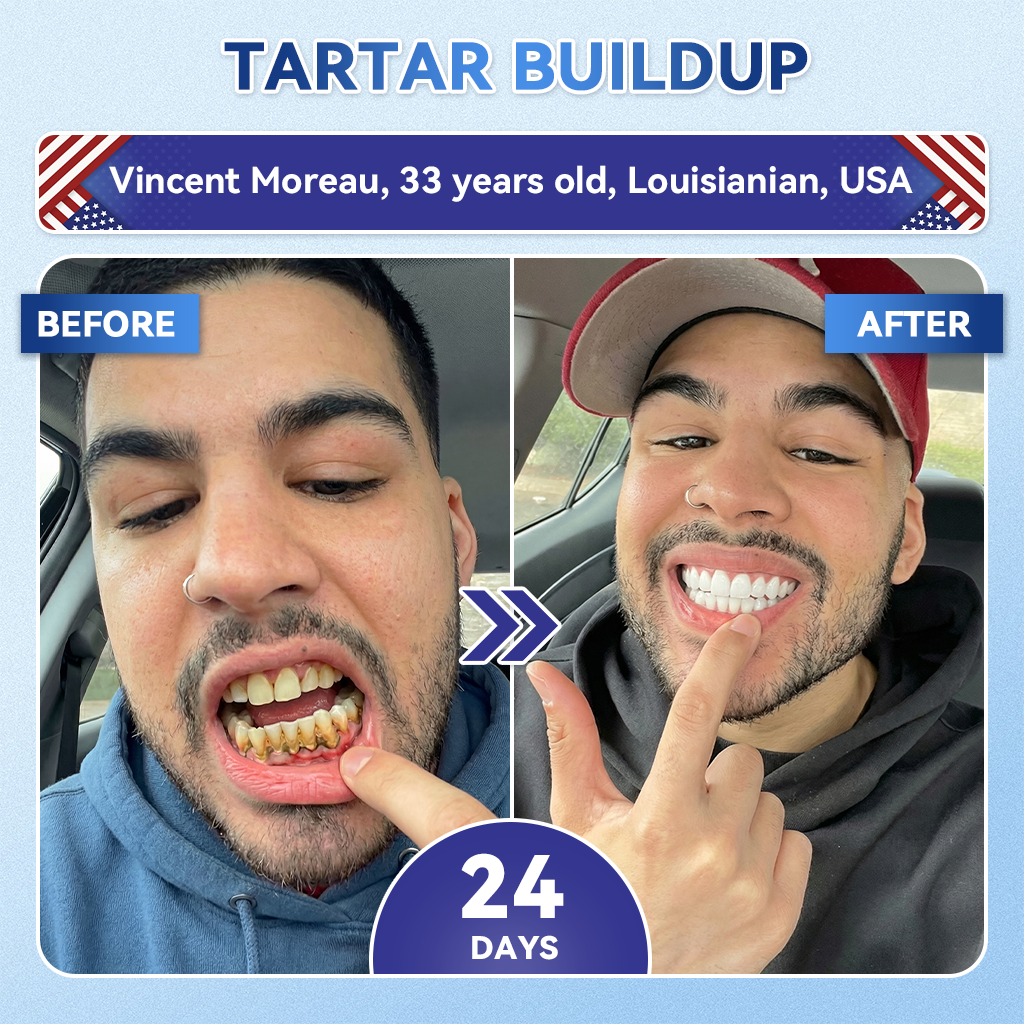 🦷GаrаgеLіnе®😜Tideglusib Fast‑Dissolving Tooth & Gum Repair Oral Strips🎨🎨(Supports tooth repair and helps relieve gum discomfort and other common oral concerns)