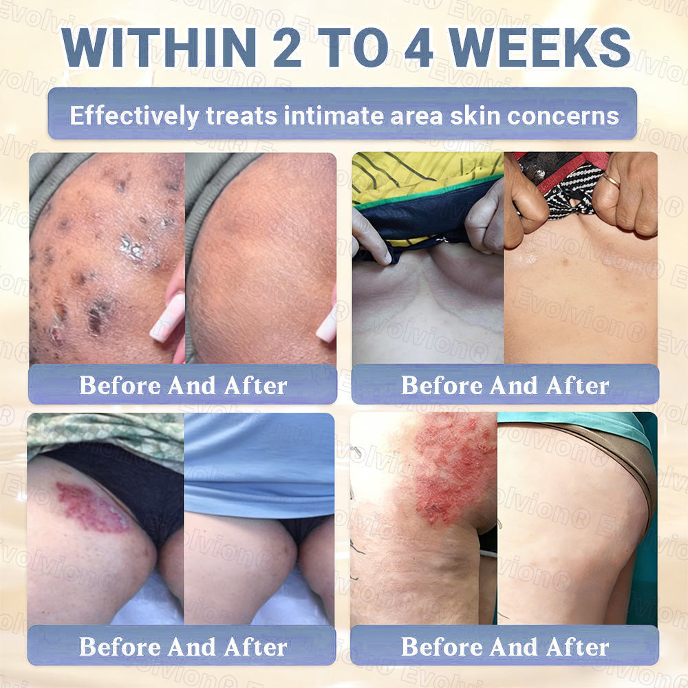 🇺🇸ТRILUMIA® Clinical Treatment & Repair Cream 🗽👩‍⚕️ – See a Noticeable Difference in Just Days A Simple, Non-Invasive Approach to Smoother, Healthier-Looking Skin
