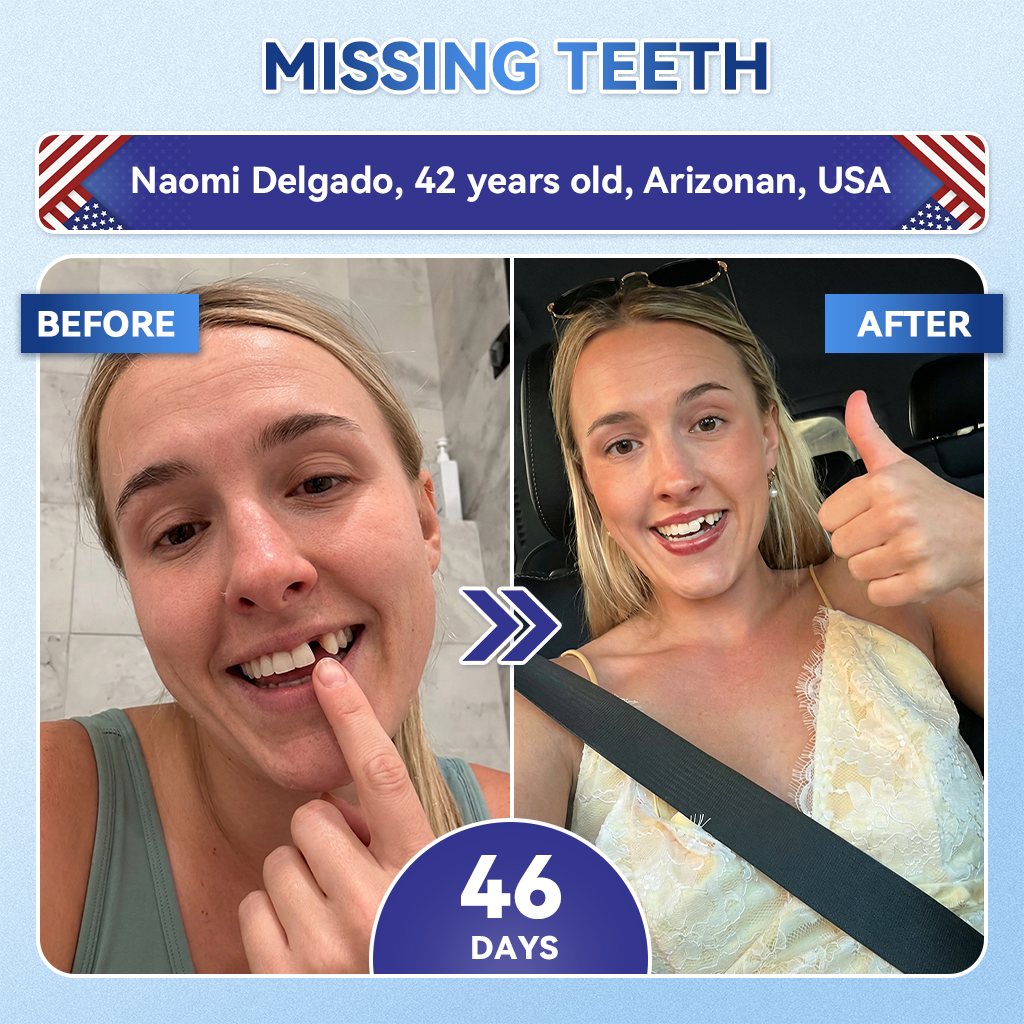 🦷GаrаgеLіnе®😜Tideglusib Fast‑Dissolving Tooth & Gum Repair Oral Strips🎨🎨(Supports tooth repair and helps relieve gum discomfort and other common oral concerns)