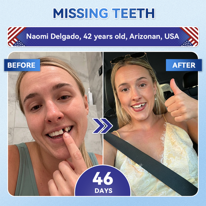 🦷GаrаgеLіnе®😜Tideglusib Fast‑Dissolving Tooth & Gum Repair Oral Strips🎨🎨(Supports tooth repair and helps relieve gum discomfort and other common oral concerns)