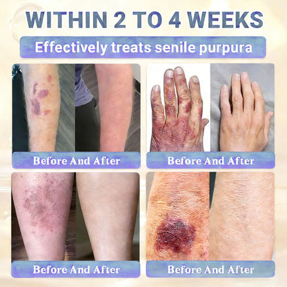 🇺🇸ТRILUMIA® Clinical Treatment & Repair Cream 🗽👩‍⚕️ – See a Noticeable Difference in Just Days A Simple, Non-Invasive Approach to Smoother, Healthier-Looking Skin
