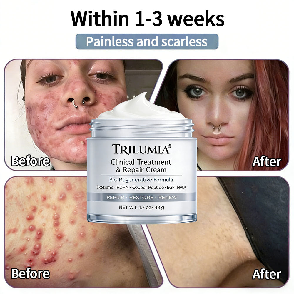 🇺🇸ТRILUMIA® Clinical Treatment & Repair Cream 🗽👩‍⚕️ – See a Noticeable Difference in Just Days A Simple, Non-Invasive Approach to Smoother, Healthier-Looking Skin