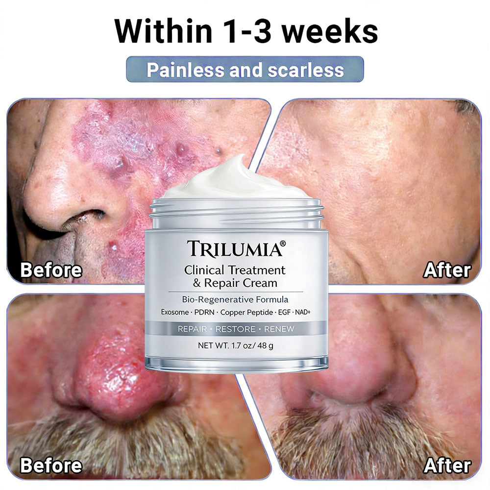🇺🇸ТRILUMIA® Clinical Treatment & Repair Cream 🗽👩‍⚕️ – See a Noticeable Difference in Just Days A Simple, Non-Invasive Approach to Smoother, Healthier-Looking Skin