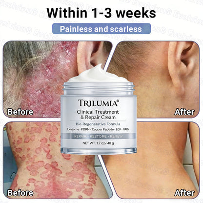 🇺🇸ТRILUMIA® Clinical Treatment & Repair Cream 🗽👩‍⚕️ – See a Noticeable Difference in Just Days A Simple, Non-Invasive Approach to Smoother, Healthier-Looking Skin
