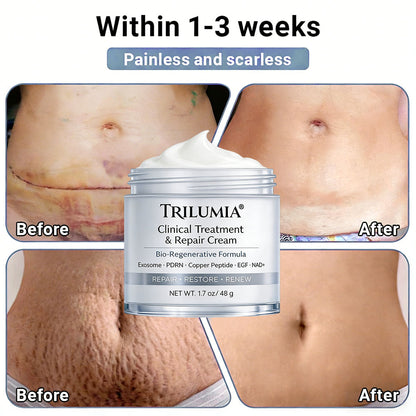 🇺🇸ТRILUMIA® Clinical Treatment & Repair Cream 🗽👩‍⚕️ – See a Noticeable Difference in Just Days A Simple, Non-Invasive Approach to Smoother, Healthier-Looking Skin