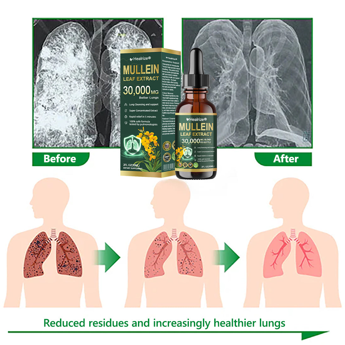 Healrize® 🌿 Organic Lung Cleansing Mullein Leaf Extract Drops Clinically proven to relieve cough, phlegm, asthma, and COPD (Chronic Obstructive Pulmonary Disease) — Breathe freely and easily.