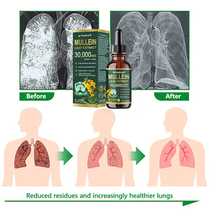 Healrize® 🌿 Organic Lung Cleansing Mullein Leaf Extract Drops Clinically proven to relieve cough, phlegm, asthma, and COPD (Chronic Obstructive Pulmonary Disease) — Breathe freely and easily.