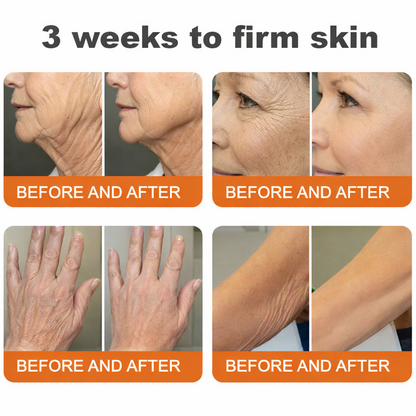 Made and Shipped from USA✨ CureVivo® Botox Bee Venom Firming Cream(🔥LAST DAY 70% OFF)💄