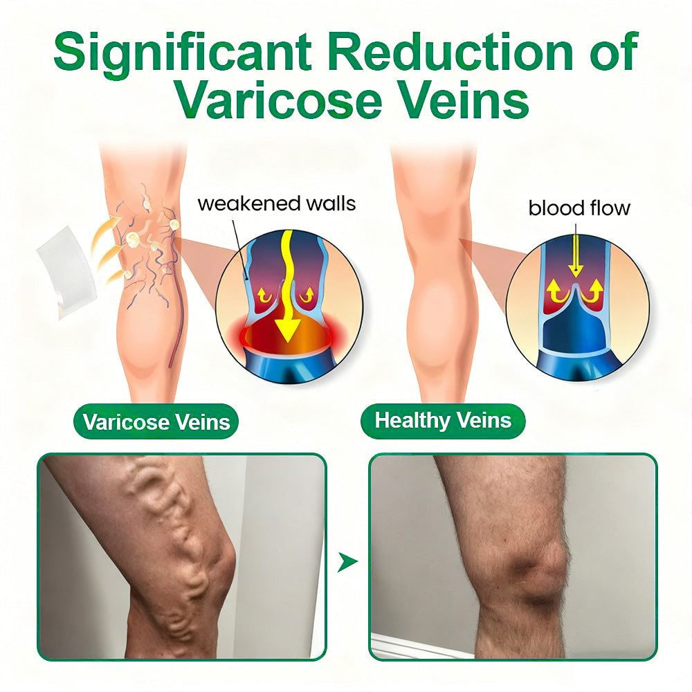 🇺🇸👨‍⚕️✅𝐇𝐞𝐚𝐥𝐫𝐢𝐳𝐞® VenoEase Soluble Microneedle Patch🗽Instant Relief, Long-Term Results 🗽