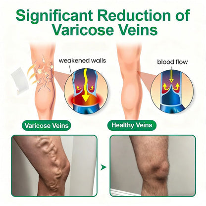 🇺🇸👨‍⚕️✅𝐇𝐞𝐚𝐥𝐫𝐢𝐳𝐞® VenoEase Soluble Microneedle Patch🗽Instant Relief, Long-Term Results 🗽