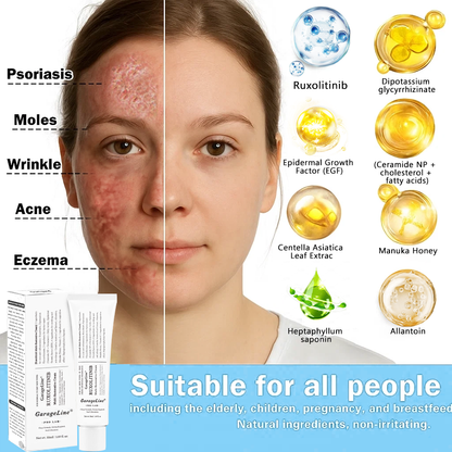【GarageLine® Official Store】JAK-Smart Ruxolitinib Repair Complex 👨‍⚕️（Zero Inflammation, 72H Sustained Release | Acne Clear in 10 Days | 97.7% Redness Reduction | Clinically Tested）