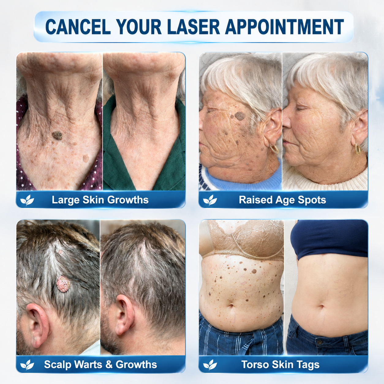 🔥🔥CureVivo® 👩‍⚕️7-Day 𝗦𝐤𝐢𝐧 𝐓𝐚𝐠 & 𝗪𝐚𝐫𝐭 𝐂𝐚𝐫𝐞 𝐏𝐫𝐞𝐜𝐢𝐬𝐢𝐨𝐧 𝐒𝐰𝐚𝐛𝐬（Individually Sealed, Single-Use）💪