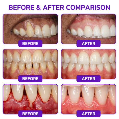 🦷Rolimey® VioCore Bee Venom Gingivitis & Periodontitis Treatment Toothpaste