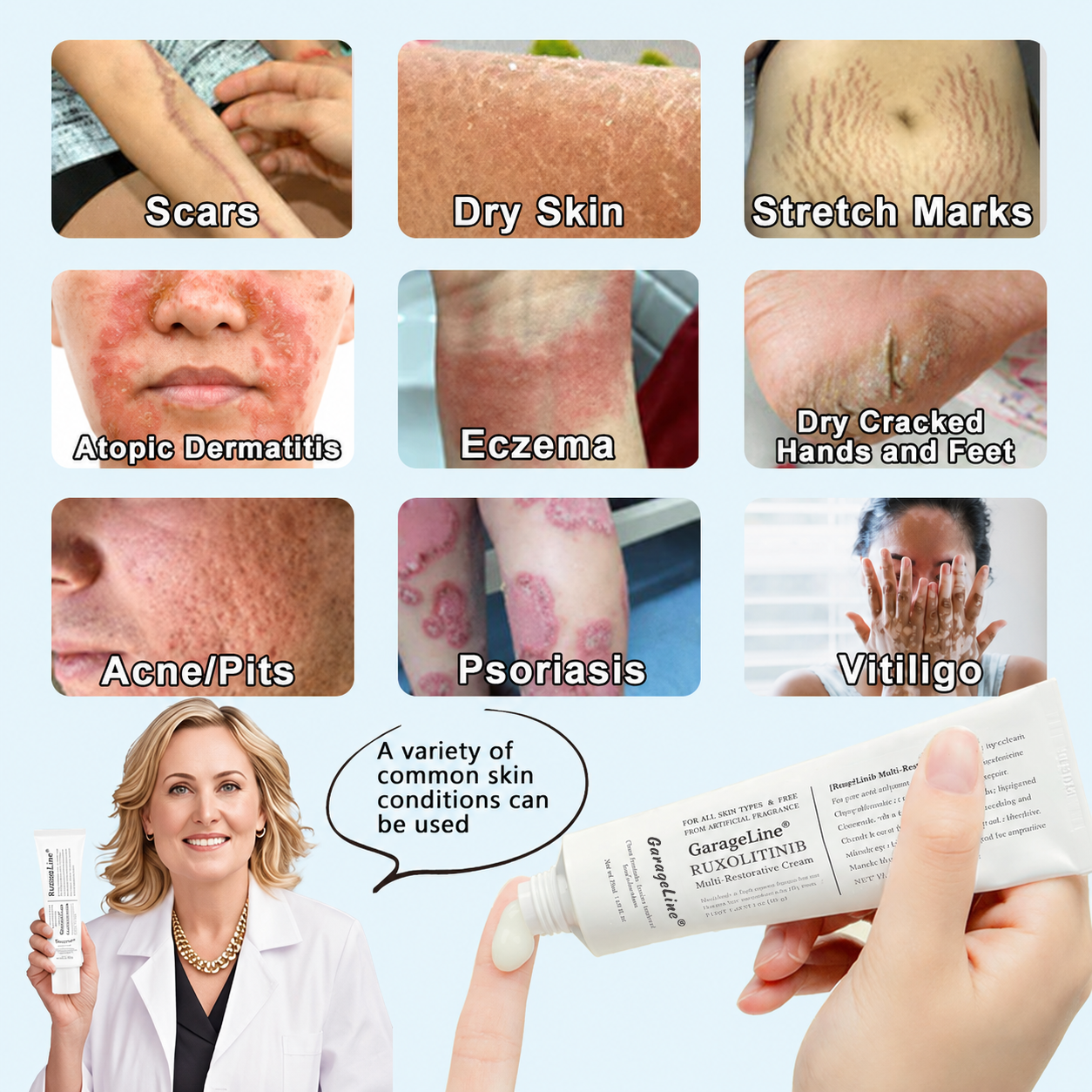 【GarageLine® Official Store】JAK-Smart Ruxolitinib Repair Complex 👨‍⚕️（Zero Inflammation, 72H Sustained Release | Acne Clear in 10 Days | 97.7% Redness Reduction | Clinically Tested）