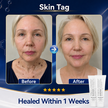 【GarageLine® Official Store】JAK-Smart Ruxolitinib Therapeutic Skin Cream 🕊️🌿