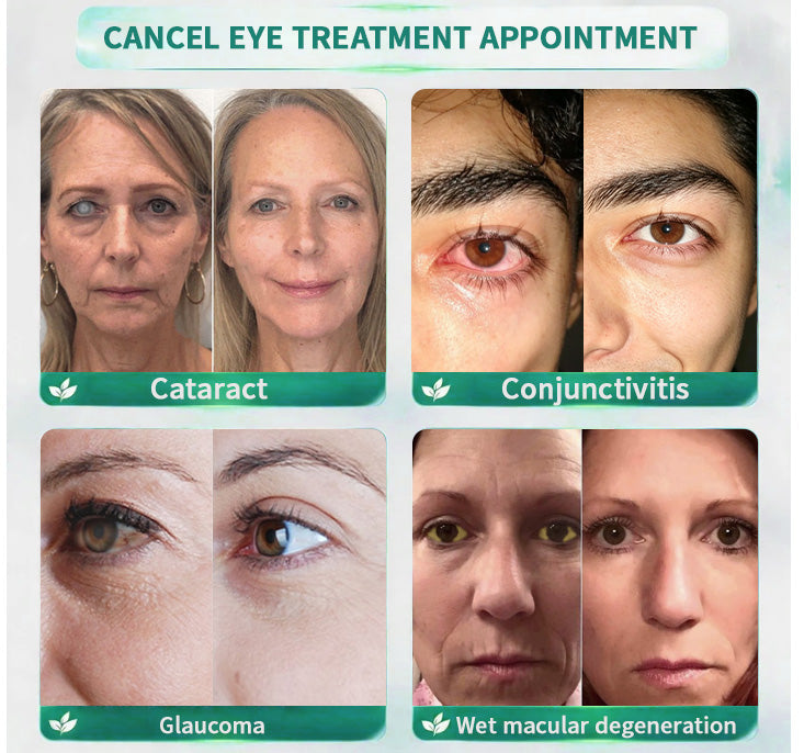 🧑‍⚕️CureVivo® Nano Clear Vision Eye Roller Serum – Professional Eye Comfort & Vision Support
