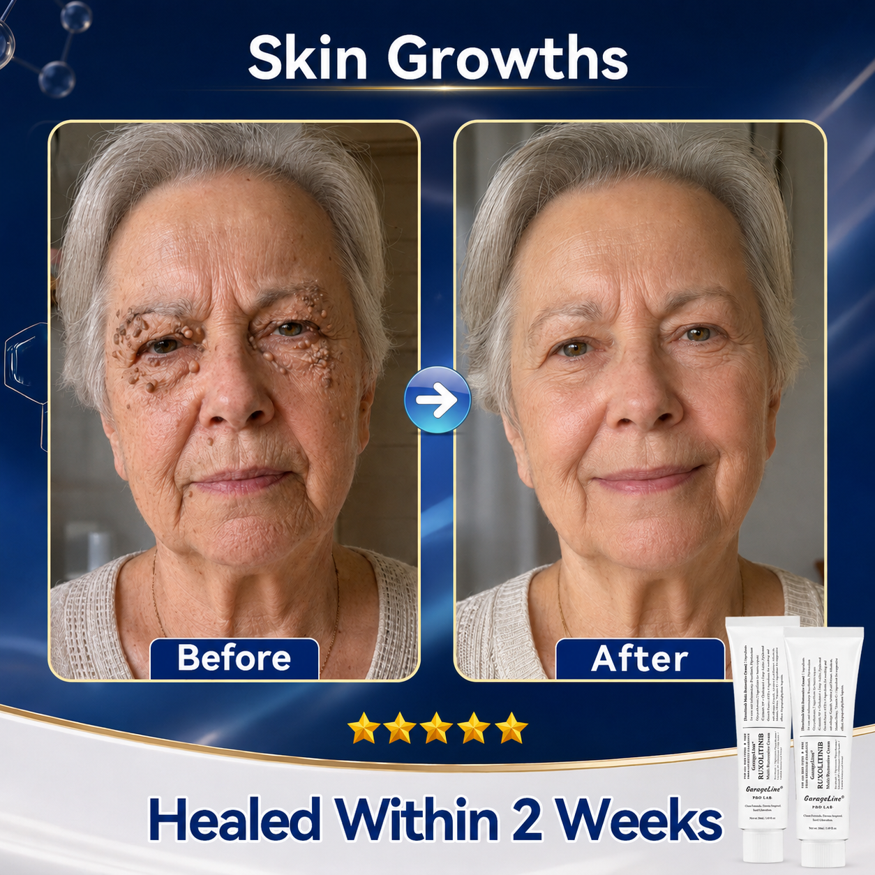 【GarageLine® Official Store】JAK-Smart Ruxolitinib Therapeutic Skin Cream 🕊️🌿