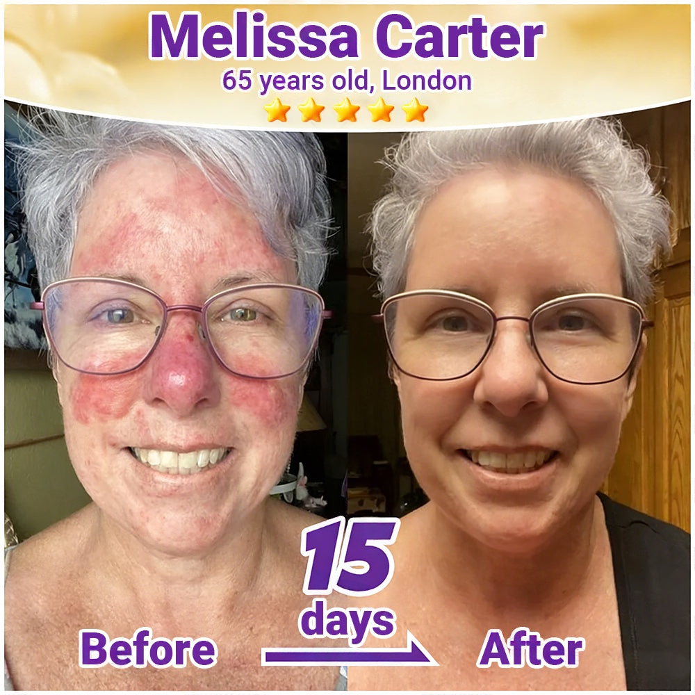 🇺🇸ТRILUMIA® Clinical Treatment & Repair Cream 🗽👩‍⚕️ – See a Noticeable Difference in Just Days A Simple, Non-Invasive Approach to Smoother, Healthier-Looking Skin