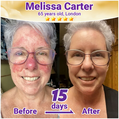 🇺🇸ТRILUMIA® Clinical Treatment & Repair Cream 🗽👩‍⚕️ – See a Noticeable Difference in Just Days A Simple, Non-Invasive Approach to Smoother, Healthier-Looking Skin