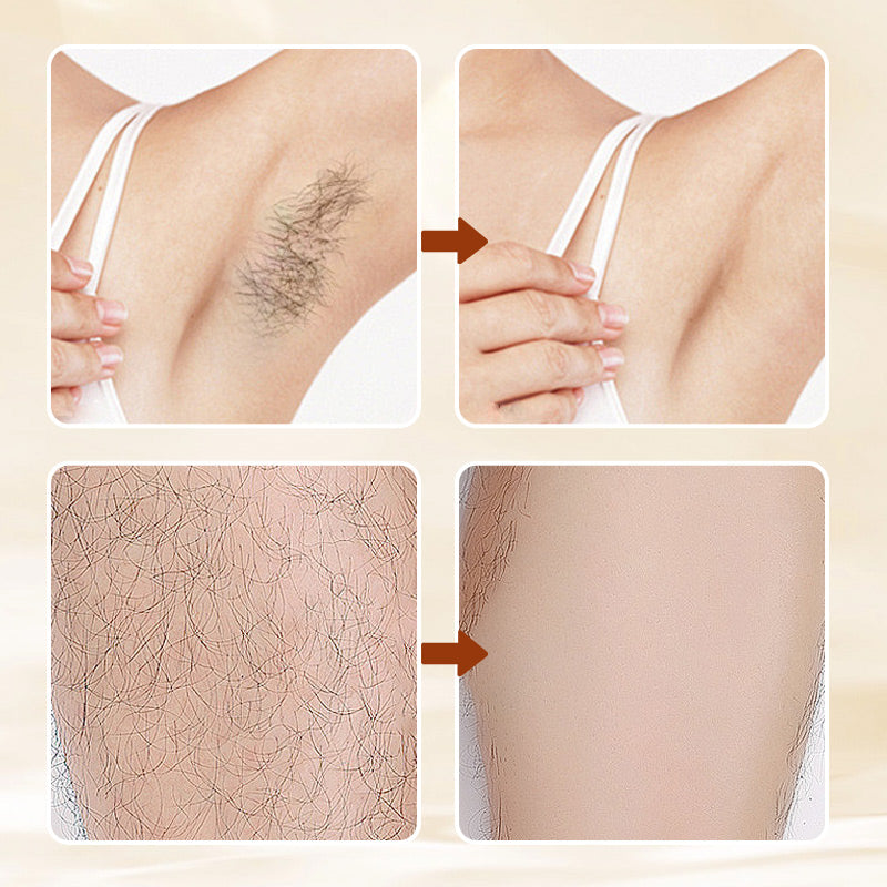🔥Trilumia Time Promotion 50% OFF✨Versatile Aromatic  Hair Removal Cream